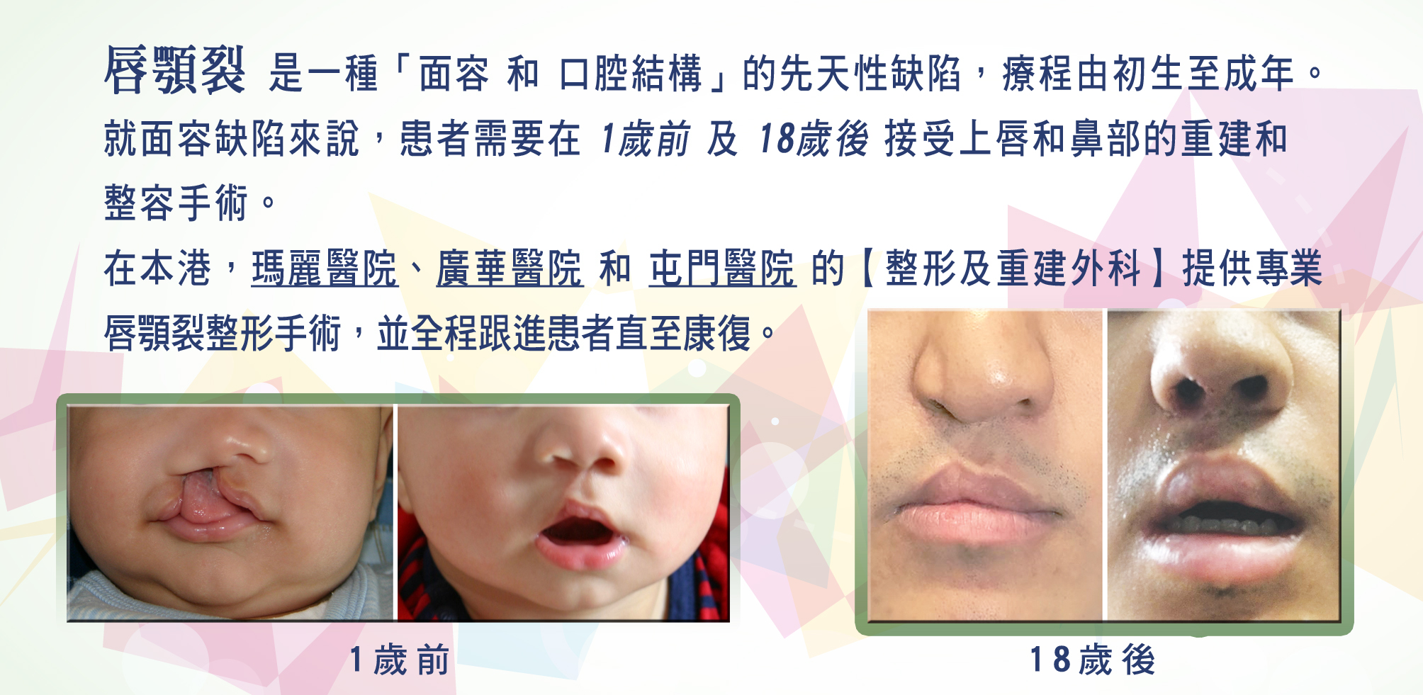 https://www.cleftlip.org.hk/wp-content/uploads/2024/11/2_Different-stage-of-plastic-surgeries-14-1.jpg