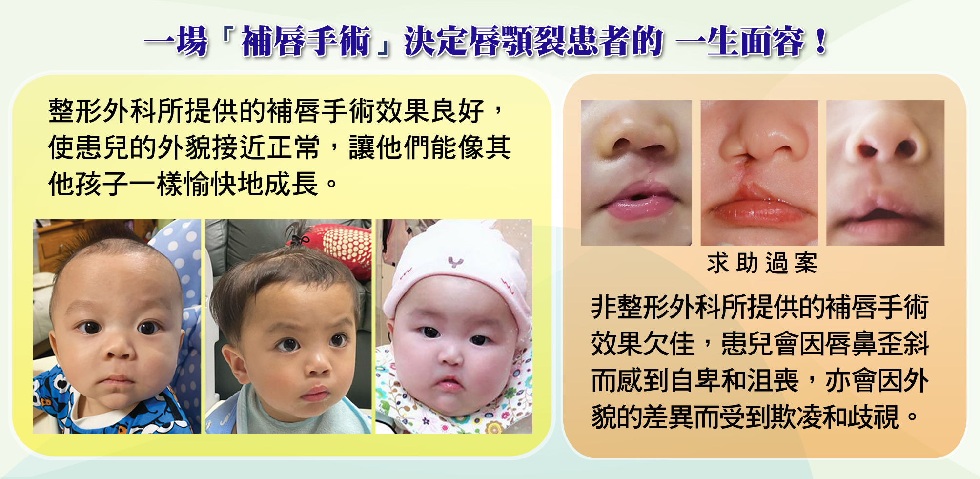 https://www.cleftlip.org.hk/wp-content/uploads/2024/11/3_Bad-good-lip-repair-13.5-1.jpg