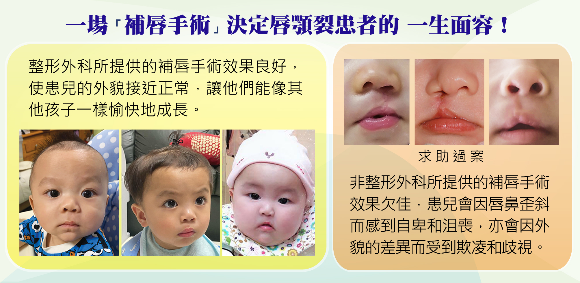 https://www.cleftlip.org.hk/wp-content/uploads/2024/11/3_Bad-good-lip-repair-13.5.jpg